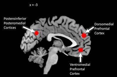 Measuring Learning in the Blink of an Eye: Adolescents' Neurophysiological Reactions Predict Long-Term Memory for Stories